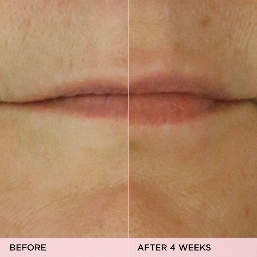 suero labial restaurador de volumen kissu lip treatment